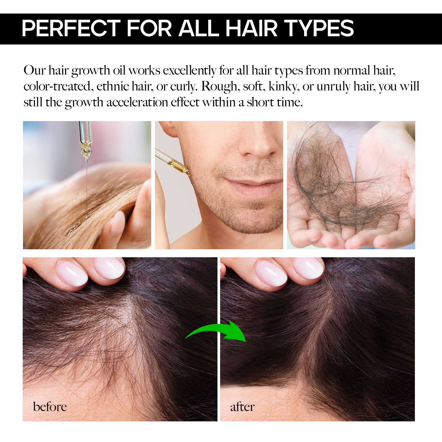 Hair Growth Oil Natural With Caffeine Biotin And Castor Hair Growth Oil For Stronger Thicker Longer Hair 1 7 Oz Upc Vigorwell